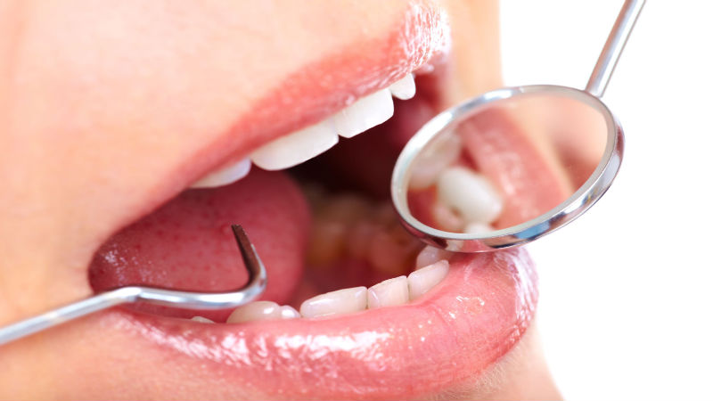 For Improved Happiness, See A Cosmetic Dentist in Queens, NY