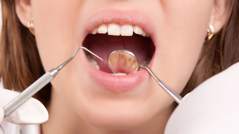 Four Steps To Finding A Great Dentist