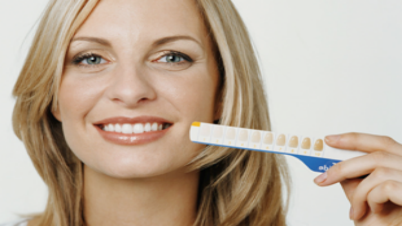 Frequently Asked Questions About Professional Teeth Whitening At A Dental Clinic