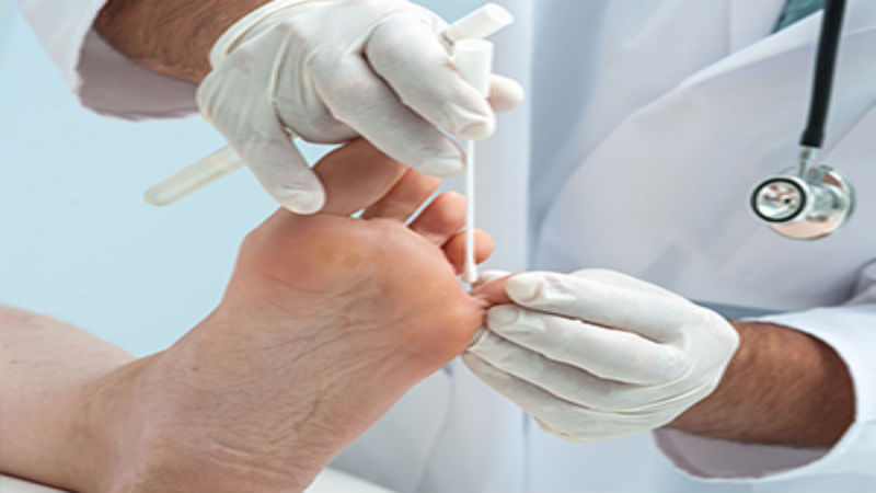 When Does an Ankle Sprain Warrant a Visit to the Ankle Specialists in Racine WI?