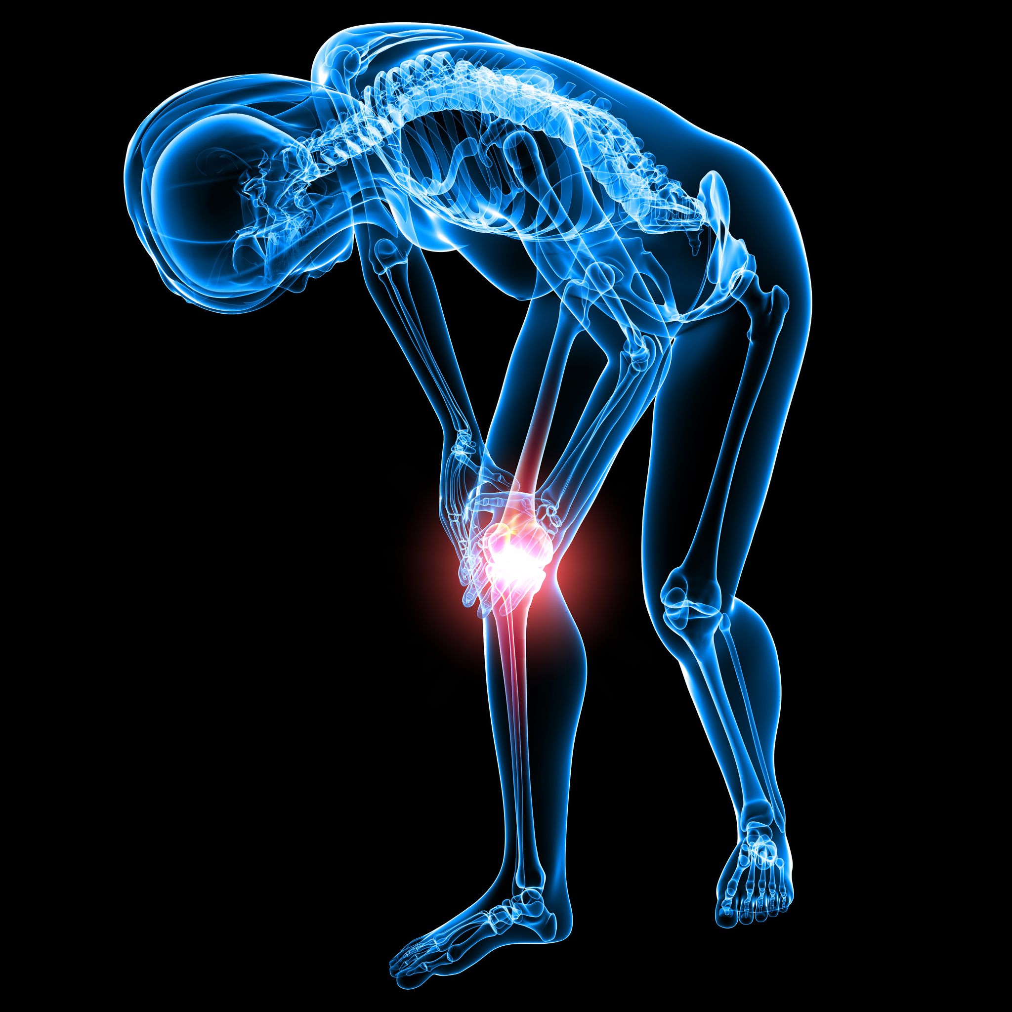 Pain Can Be Treated With Regenerative Medicine in Lawrence KS