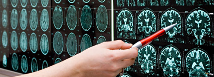 Importance of Diagnostic Exams like Radiology Imaging